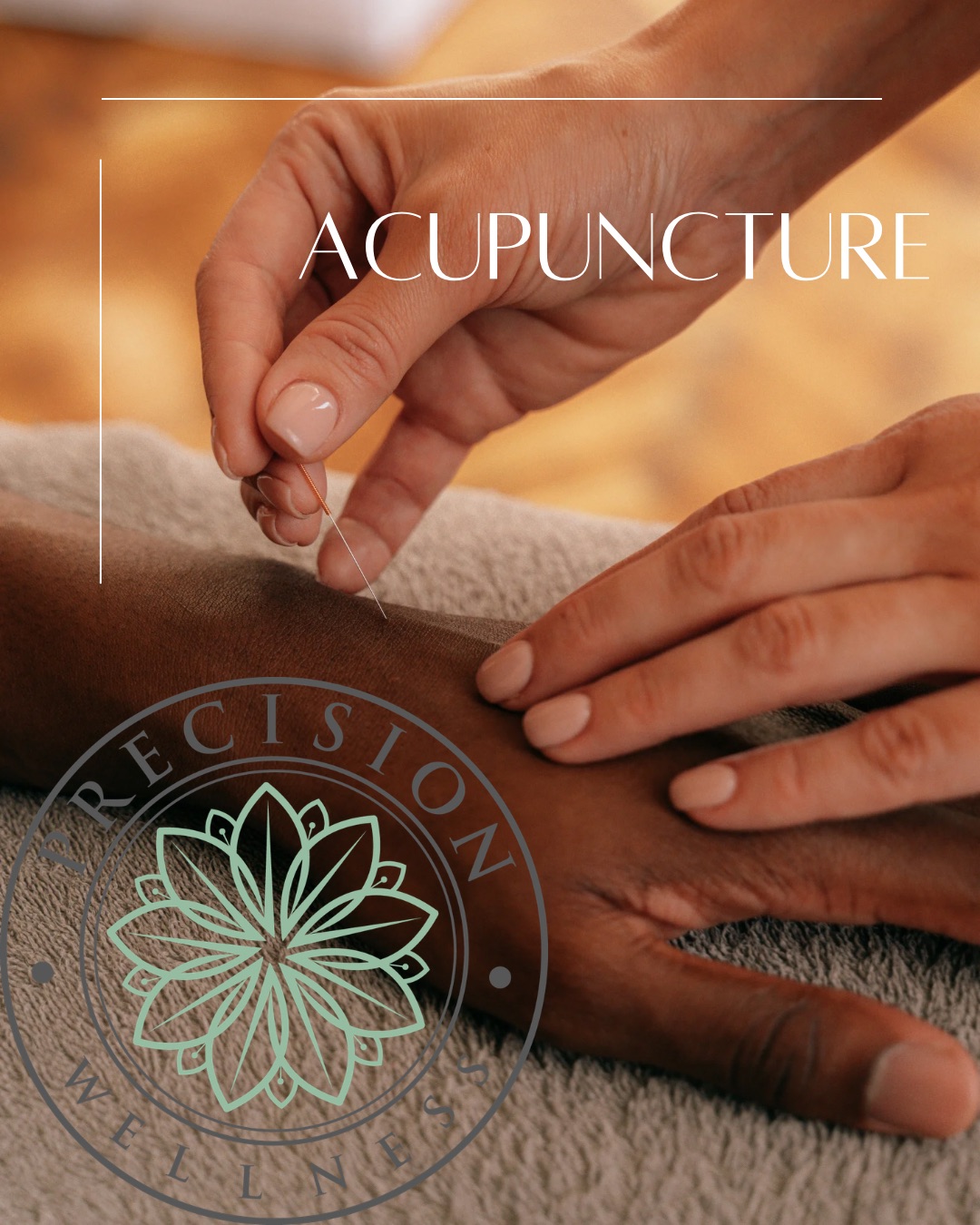 Acupuncture in Springfield, MO: Benefits, What to Expect, and Who It Can Help